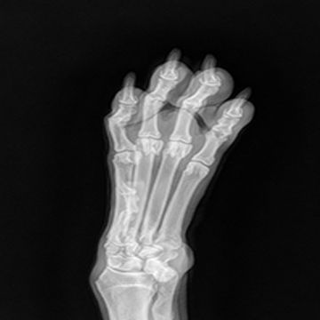 COVETO - Comment fonctionne la radiologie numérique ?
