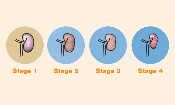 what is stage 3 kidney disease in dogs